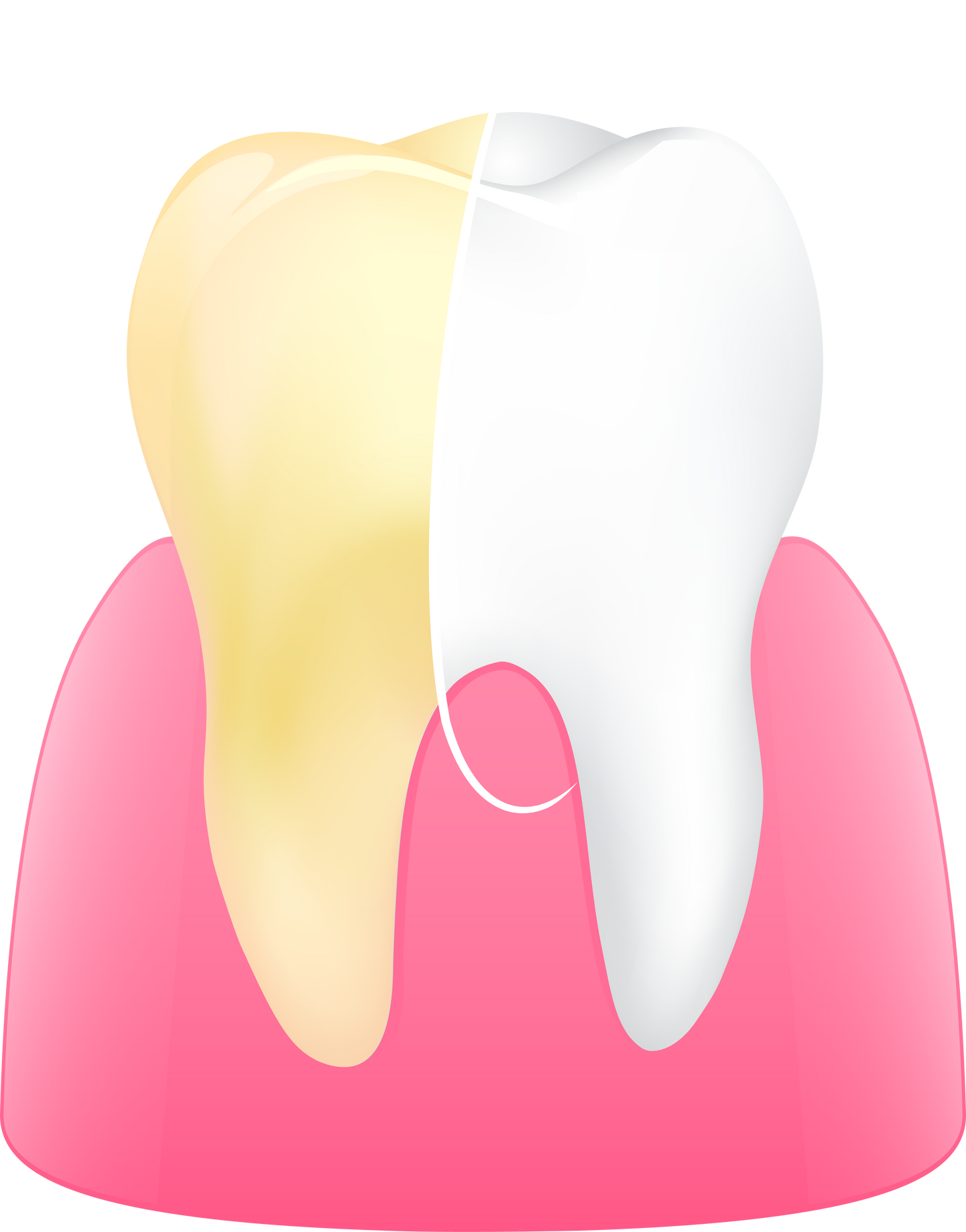 tooth cleaning